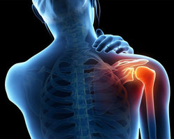 Reduce Joint Pain & Inflammation